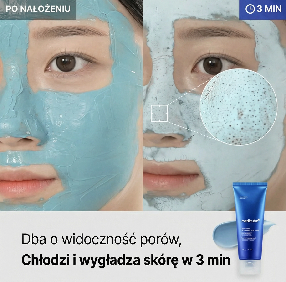 Maseczka Błotna do Twarzy Zero Pore na Wągry 100 ml