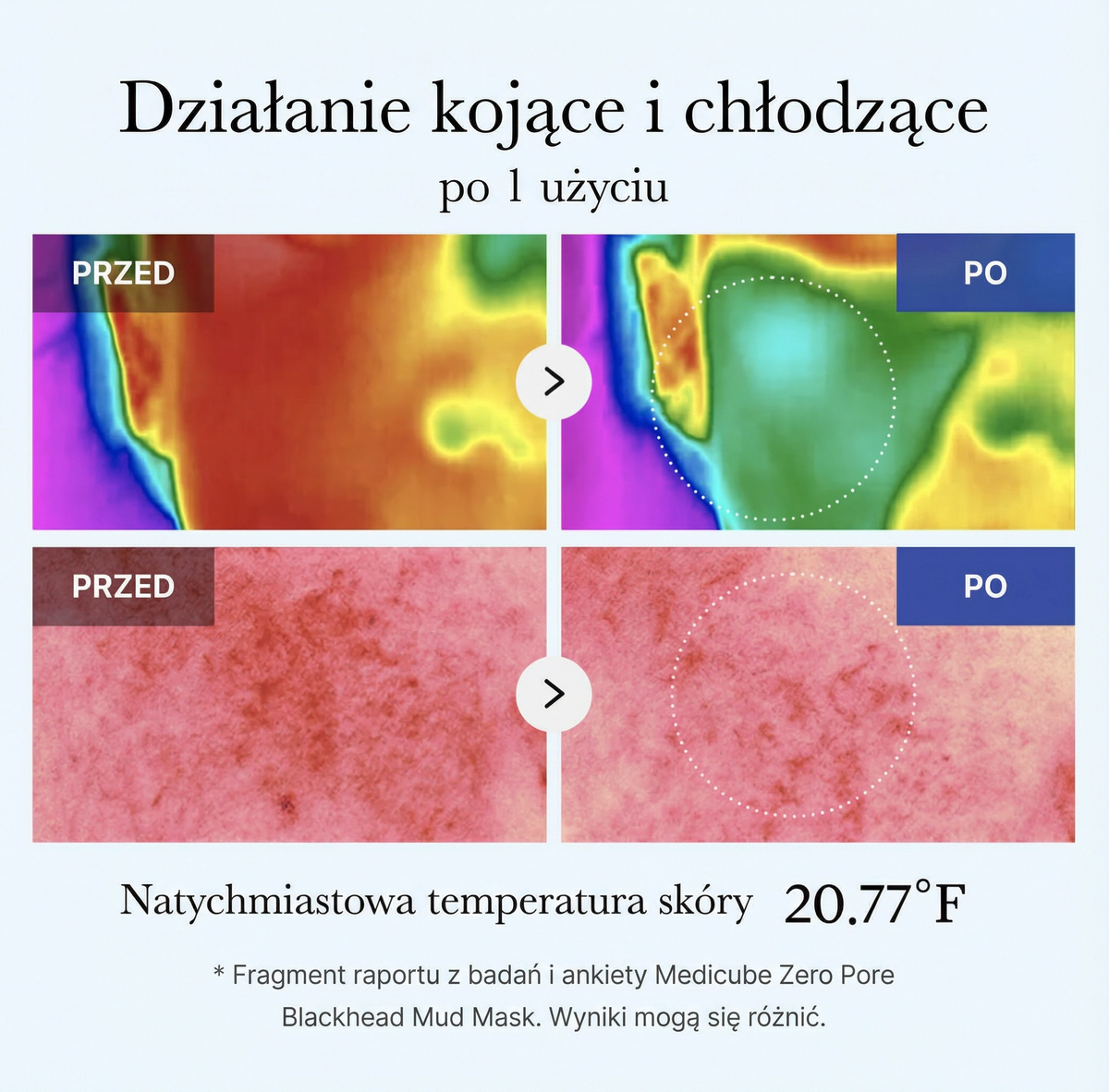 Maseczka Błotna do Twarzy Zero Pore na Wągry 100 ml