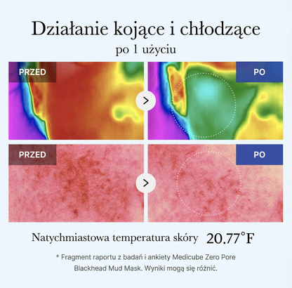 Maseczka Błotna do Twarzy Zero Pore na Wągry 100 ml