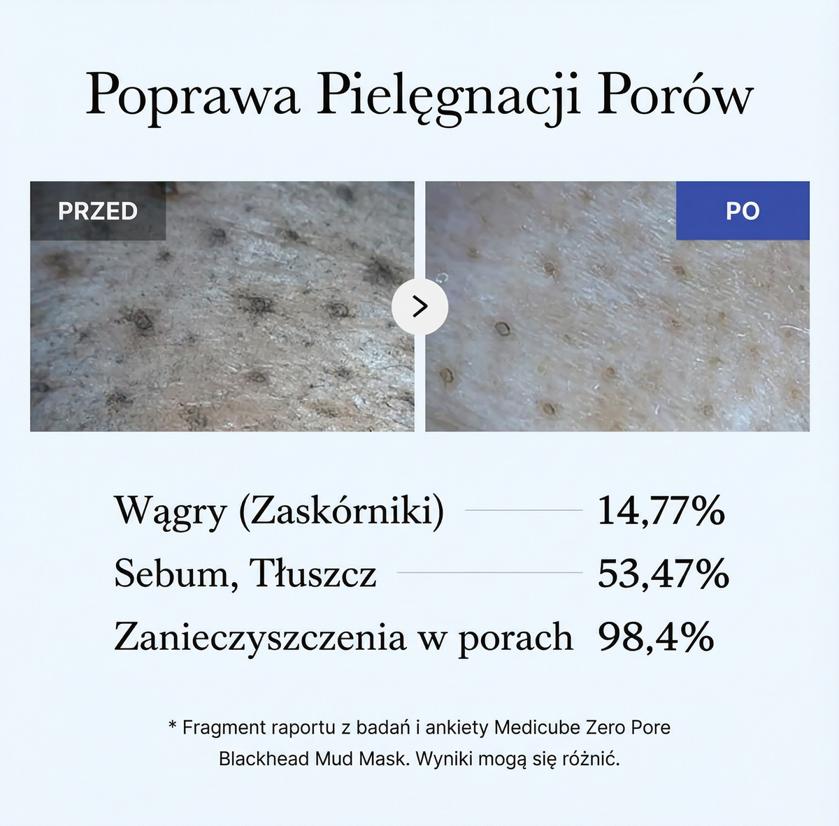 Maseczka Błotna do Twarzy Zero Pore na Wągry 100 ml