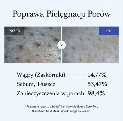 Maseczka Błotna do Twarzy Zero Pore na Wągry 100 ml