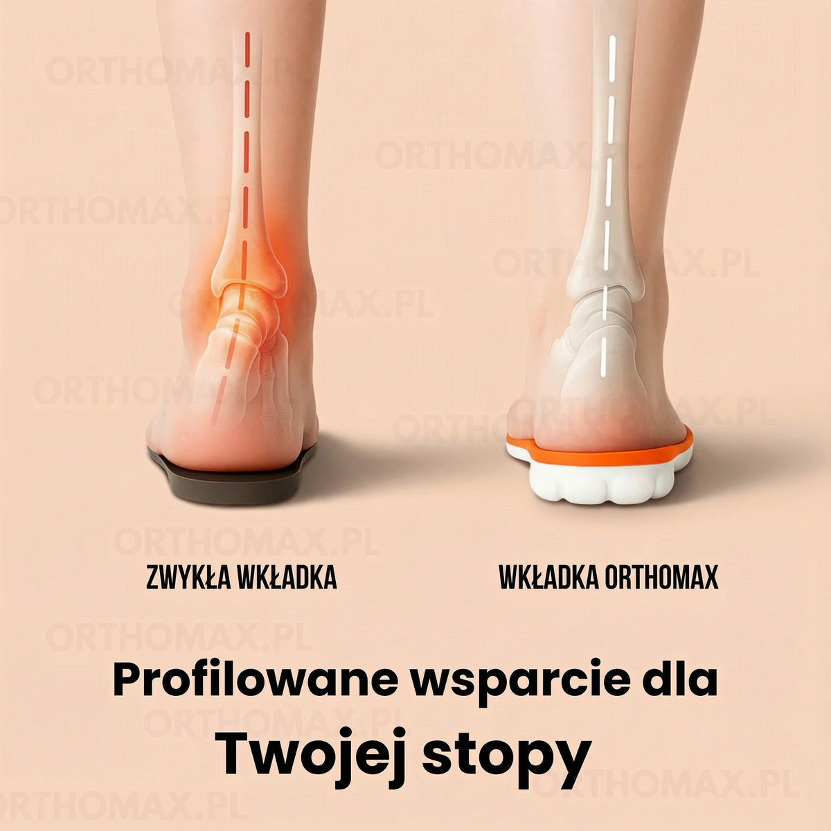 Orthomax Opedyczne do Butów z Ergonomicznym Wsparciem | Komfort i Amortyzacja dla Zdrowia Stóp
