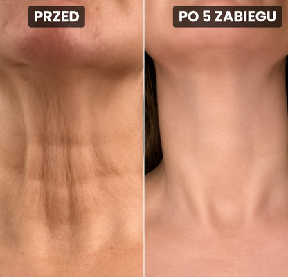 Zestaw Nawilżający Mikroinfuzji z Serum Nuvelle do Wszystkich Typów Skóry