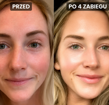 Zestaw Nawilżający Mikroinfuzji z Serum Nuvelle do Wszystkich Typów Skóry